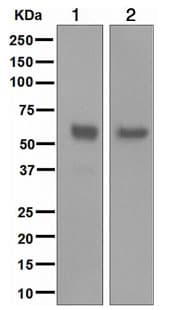 Neto2 Antibody Epr3497 Bsa And Azide Free Ab247819  Western Blot Img136482