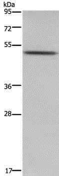 Pkmyt1 Antibody Ab200387  Western Blot Img58853