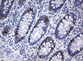 Anti-Ki67 antibody [OTI5D7](AB156956)