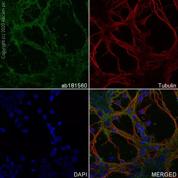 Anti-Pan Trk antibody [EPR17341](AB181560)