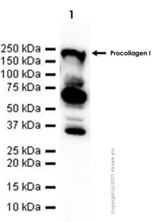 Anti-Collagen I antibody [EPR24331-53](AB270993)
