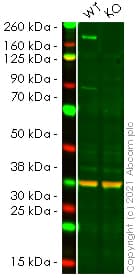 Anti-ErbB2 / HER2 antibody [EP1045Y](AB134182)