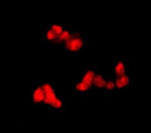 Anti-Choline Acetyltransferase antibody [EPR13024(B)](AB181023)