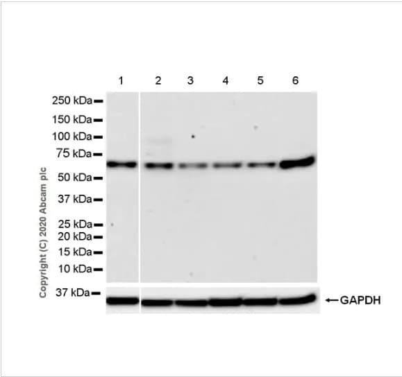 Anti-PHD finger protein 1/PHF1 antibody [EPR14222](AB184951)