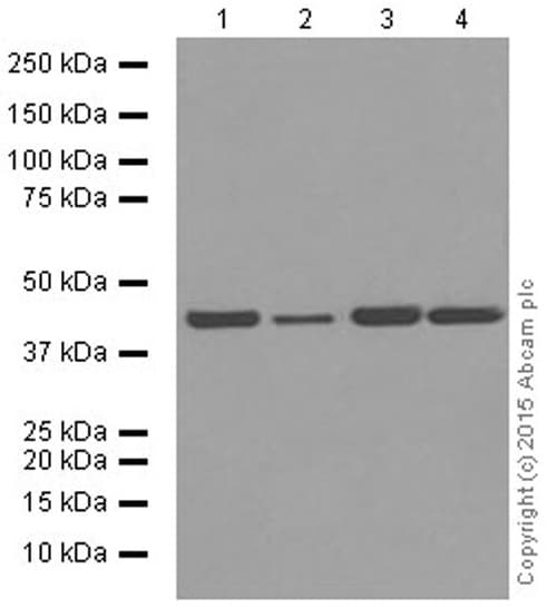 Anti-alpha smooth muscle Actin (acetyl E3) + ACTG2 (acetyl E3) antibody [E184](AB32575)