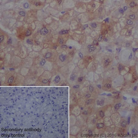 Jak1 Phospho Y1034 Y1035 Antibody Epr18992 Ab138005  Immunohistochemistry Formalin Pfa Fixed Paraffin Embedded Sections Img25016