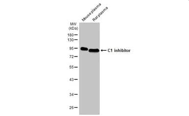 Anti-C1 inhibitor antibody [HL1196] - BSA and Azide free(ab313834)