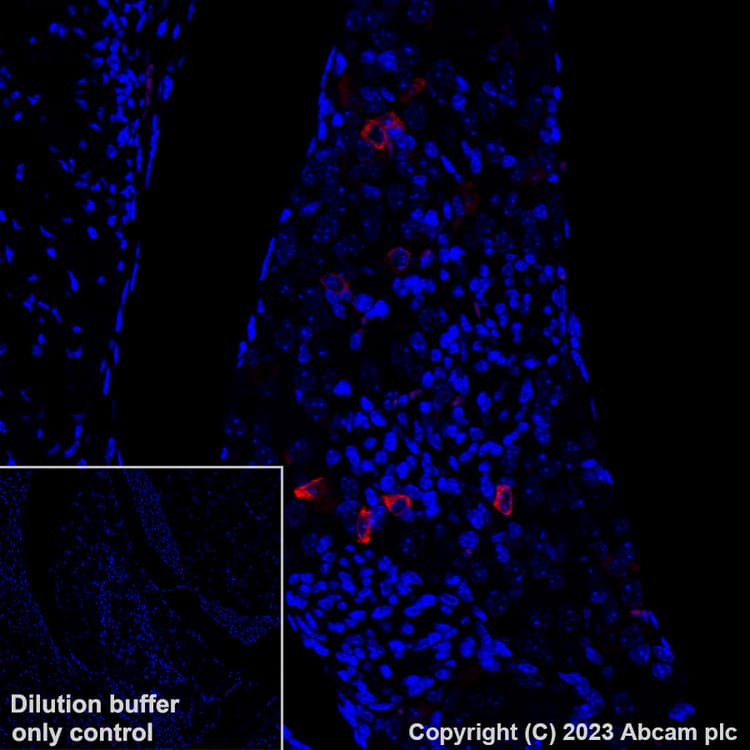 Alexa Fluor 647 Trpv1 Antibody Epr25057 67 Ab313673  Immunohistochemistry Formalin Pfa Fixed Paraffin Embedded Sections Img418124