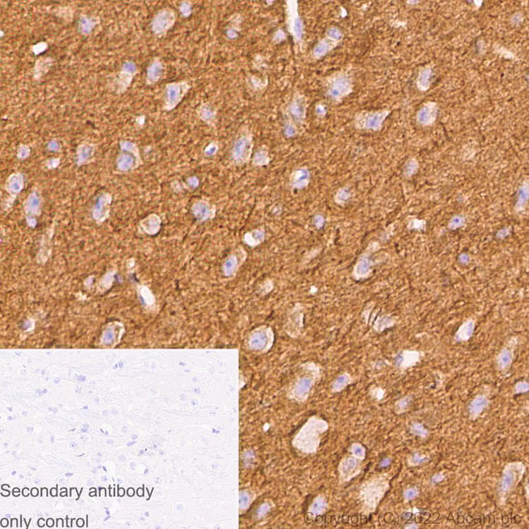 Anti-alpha Tubulin acetyl K40 antibody [EPR16772] - Rat IgG2a (Chimeric)(AB289863)