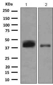 Anti-CD1c antibody [EPR9638](AB167419)