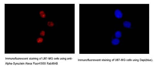 Anti-Alpha-synuclein antibody [MJFR1](AB138501)