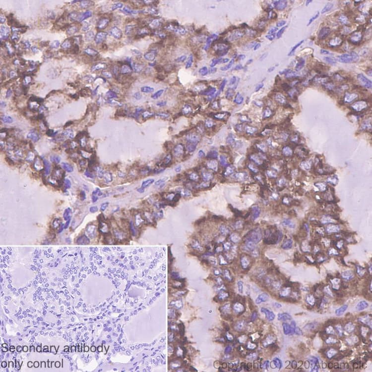 Snx5 Antibody Epr14358 Bsa And Azide Free Ab250218  Immunohistochemistry Formalin Pfa Fixed Paraffin Embedded Sections Img168647