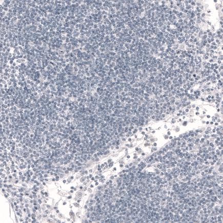 Anti-FOXP2 antibody [CL5312](AB243038)