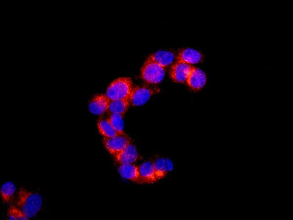 Anti-Perilipin-1 antibody [EPR3753(2)](AB172907)