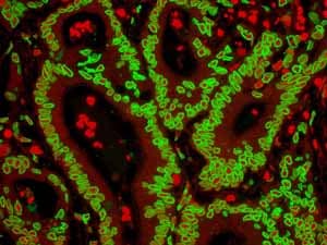 Anti-Lamin A + Lamin C antibody [EPR4100] - Nuclear Envelope Marker(AB108595)