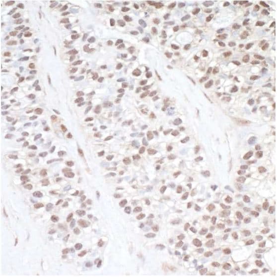 Cdk11 Cdc2l2 Cdk11a Antibody Ab19393  Immunohistochemistry Formalin Pfa Fixed Paraffin Embedded Sections Img180446
