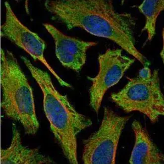 Anti-Villin antibody(AB97512)