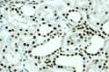 Gtpbp4 Nog1 Antibody Epr3500 Ab92342  Immunohistochemistry Formalin Pfa Fixed Paraffin Embedded Sections Img135605