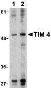 Anti-TIM 4 antibody(AB47637)