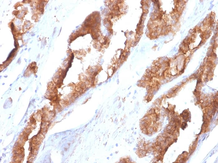 Hsp27 Antibody Cptc Hspb1 2 Ab268073  Immunohistochemistry Formalin Pfa Fixed Paraffin Embedded Sections Img61521