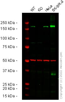 Anti-ErbB2 / HER2 antibody [EP1045Y](AB134182)