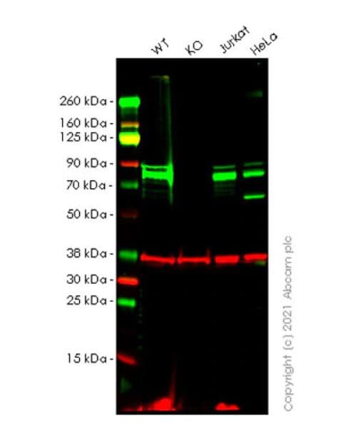 Anti-CENPB antibody [EPR24047-64](AB259855)