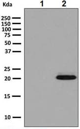 Anti-SOD2/MnSOD (acetyl K68) antibody [EPVANR2](AB137037)