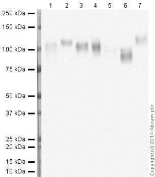 Anti-LAMP2 antibody [H4B4] - Lysosome Marker(AB25631)