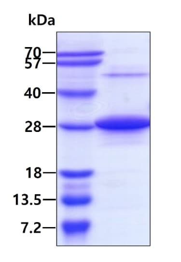 Recombinant Human RAB7 protein(AB103507)