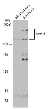 Anti-Nav1.7 antibody(AB272931)