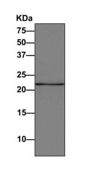 Proteasome Subunit Beta Type 2 Psmb2 Antibody Epr88262b Bsa And Azide Free Ab249366  Western Blot Img45652