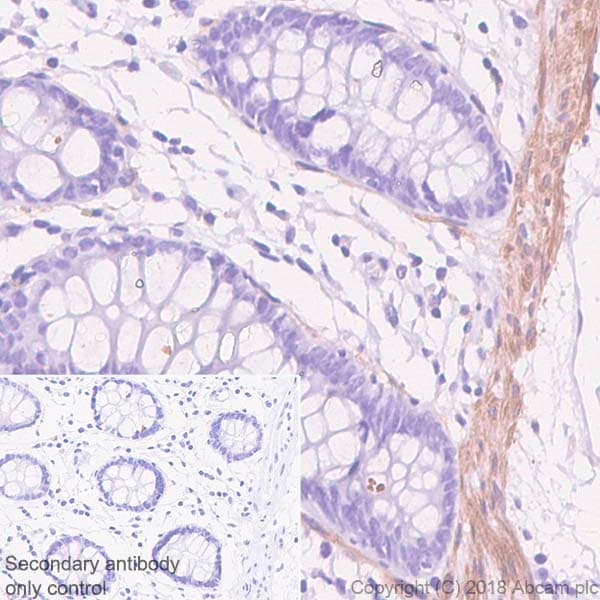 Anti-Calponin 1 antibody [SP180] - C-terminal(AB227660)