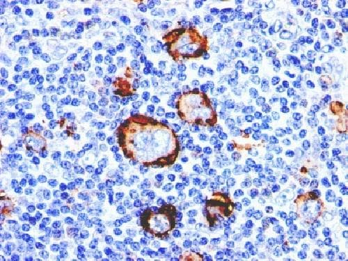 Cd15 Antibody Leu M1 Bsa And Azide Free Ab212391  Immunohistochemistry Formalin Pfa Fixed Paraffin Embedded Sections Img120319