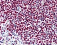 Anti-PARP1 antibody [A6.4.12](AB110915)