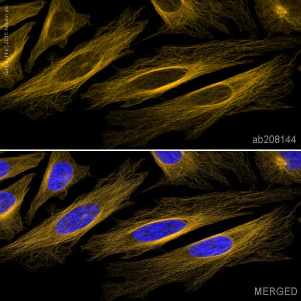Alexa Fluor® 568 Anti-beta Tubulin antibody [EPR16774](AB208144)