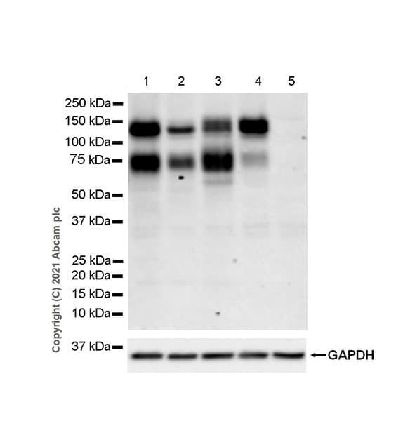 Anti-DDR2 antibody [EPR18826-119] - BSA and Azide free(AB280369)