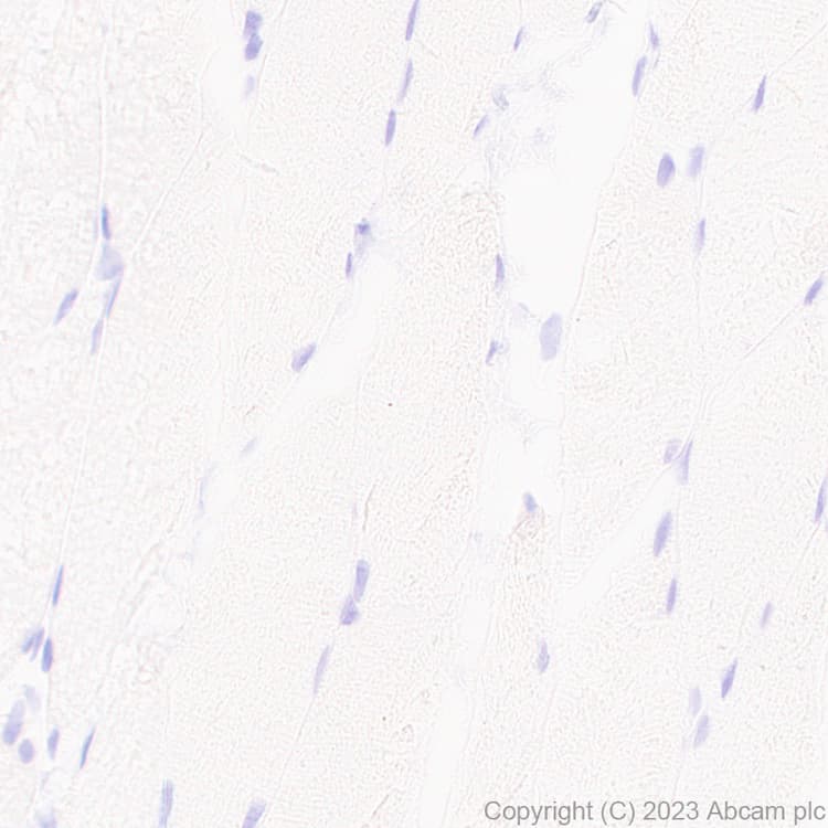 Pan Cytokeratin Antibody Epr28285 45 Bsa And Azide Free Ab308263  Immunohistochemistry Formalin Pfa Fixed Paraffin Embedded Sections Img408899