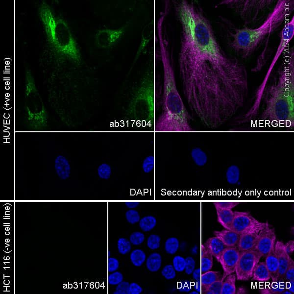 Pai1 Antibody Epr21850 262 Bsa And Azide Free Ab317605  Immunocytochemistry Immunofluorescence Img431885
