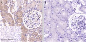Anti-PKC alpha (phospho T497) antibody [EP2608Y] - BSA and Azide free(AB284734)