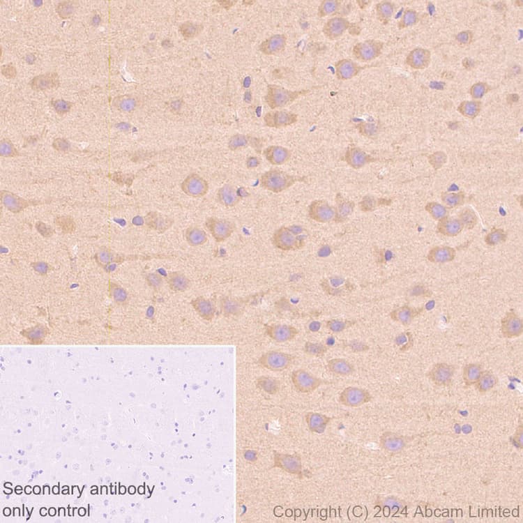 Mtor Antibody Rm1258 Ab322444  Immunohistochemistry Formalin Pfa Fixed Paraffin Embedded Sections Img438199