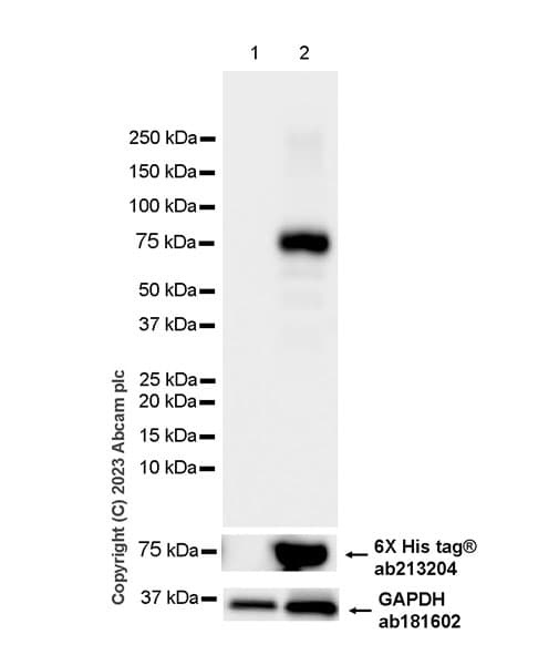 Anti-Aggrecan antibody [EPR28034-86](AB313636)