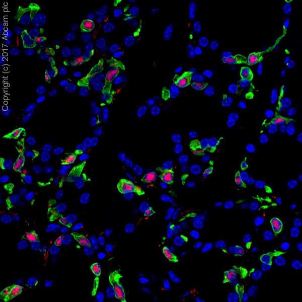 Anti-MASH1/Achaete-scute homolog 1 antibody [EPR19840](AB211327)