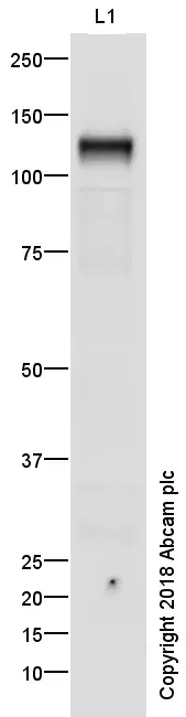 Anti-VE Cadherin antibody - Intercellular Junction Marker(AB33168)