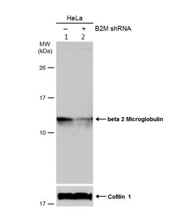 Beta 2 Microglobulin Antibody Ab227261  Western Blot Img450539