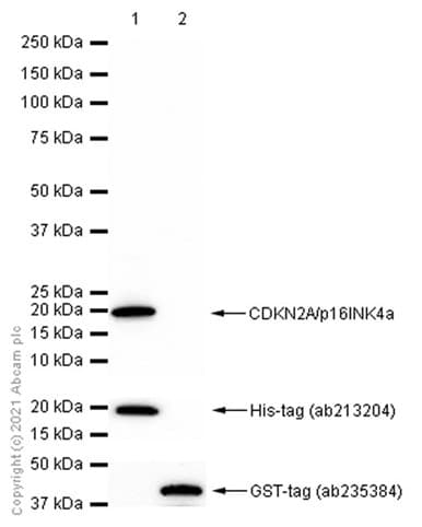 Anti-CDKN2A/p16INK4a antibody [EPR1473] - C-terminal(AB108349)