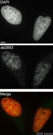 Anti-gamma H2A.X (phospho S139) antibody(AB2893)