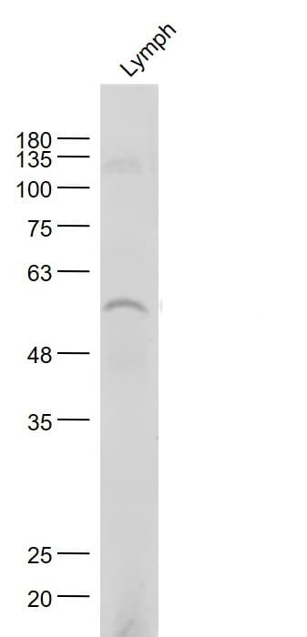 Anti-Nicotinic Acetylcholine Receptor alpha 7 antibody(AB216485)