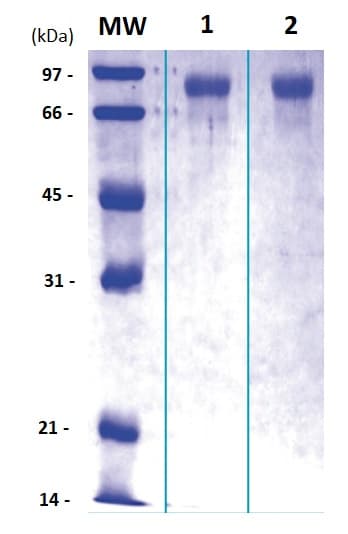 Recombinant Human PI-16 protein(AB117229)
