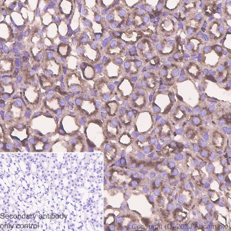 Snx5 Antibody Epr14358 Bsa And Azide Free Ab250218  Immunohistochemistry Formalin Pfa Fixed Paraffin Embedded Sections Img172245