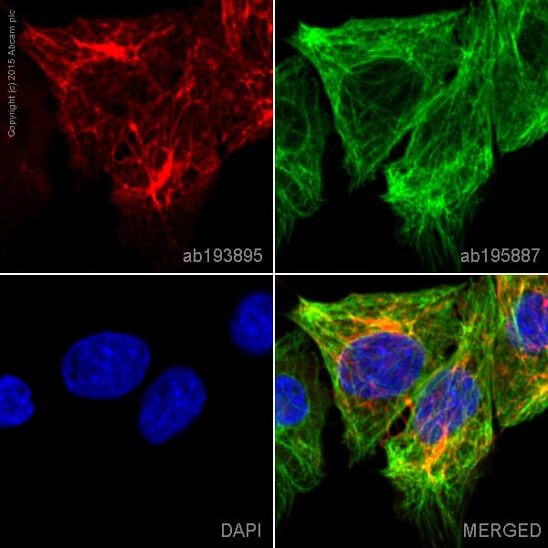 Alexa Fluor 647 Cytokeratin 5 Antibody Ep1601y Ab193895  Immunocytochemistry Immunofluorescence Img108977